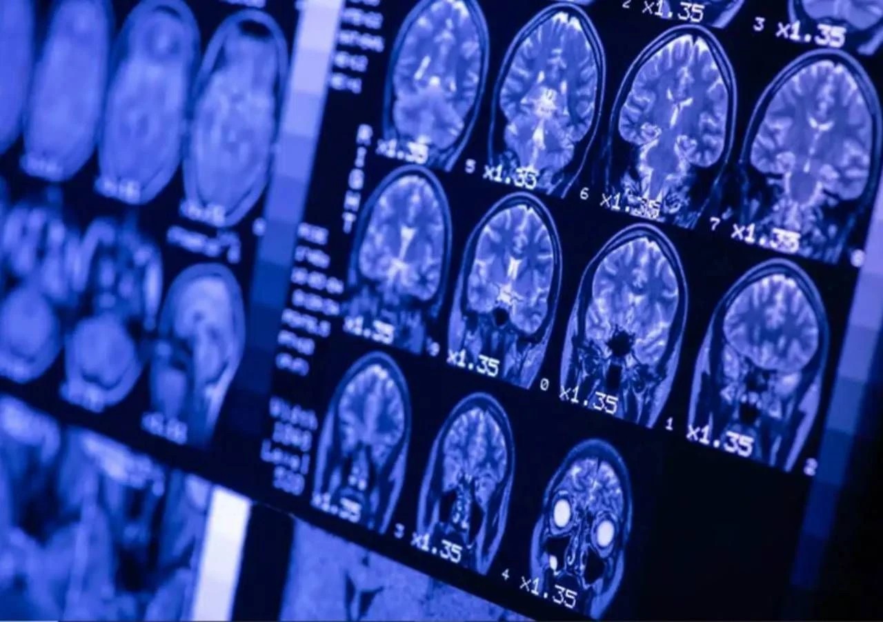 pesquisadores-japoneses-criam-tecnologia-que-permite-gravar-e-assistir-sonhos-humanos-1740604388785_1280 “Já pensou em assistir aos seus próprios sonhos como um filme? Essa tecnologia agora é real”